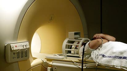 A midlife MRI that spots rapid aging and signals disease long before symptoms