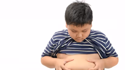childhood obesity