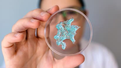 Microplastics discovered in human reproductive fluids