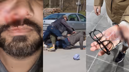 Attack on Indians In Ireland