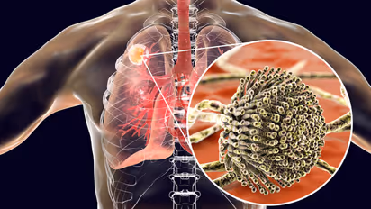 health risks of mold