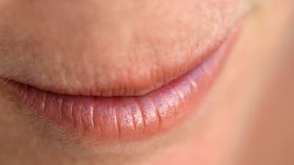 dry lips
