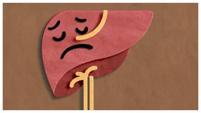 fatty liver