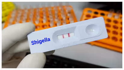 Shigella Cases in Kerala