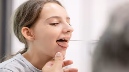 Why Do Mouth Ulcers Increase in Summer Causes and Prevention Tips
