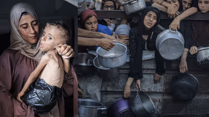 gaza starvation death 
