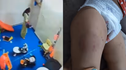 day care child attack