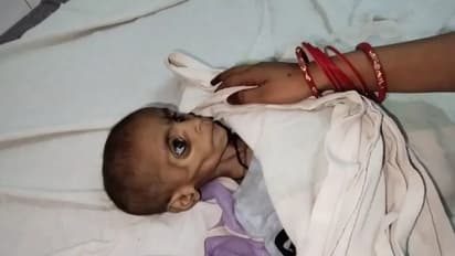 Malnutrition child death madhya pradesh