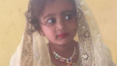 girl dies of rabbies