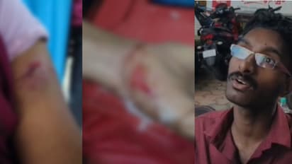 stray dog attack in pathanamthitta