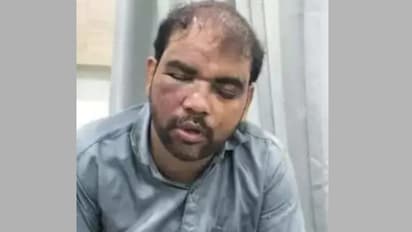 local vendor injured after jumping from train 