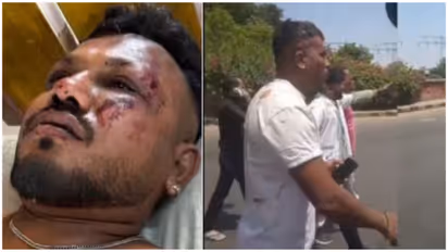 air india crash vishwas