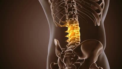 Spinal Fracture Treatment