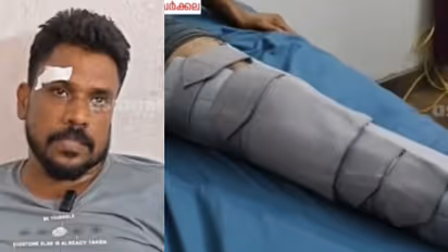 workshop owner attacked in kollam