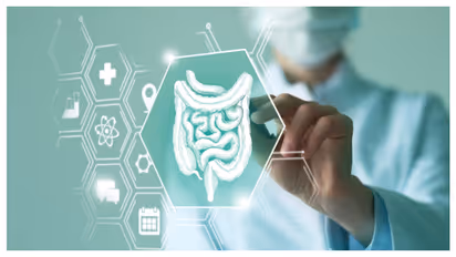colon cancer