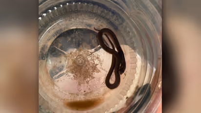 Kozhikode Snake Bite