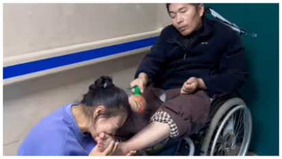 Wife bites husband's leg