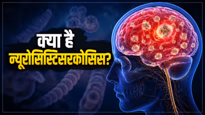 Neurocysticercosis