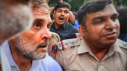 Rahul gandhi nose blood