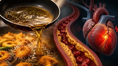 Cooking-Oil-Health-Effects