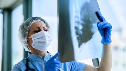 lung-damage-due-to-covid-19