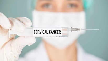 cervical cancer