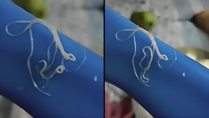 Viral Video White Worms Found In Cabbage Here is What You Should Know About Thread Like Worms