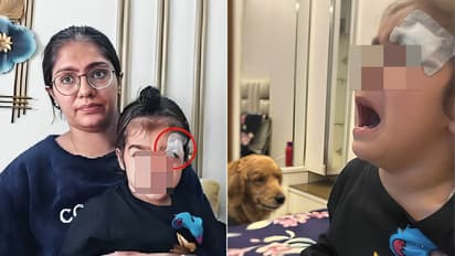 UP shocker Meerut baby eye injury