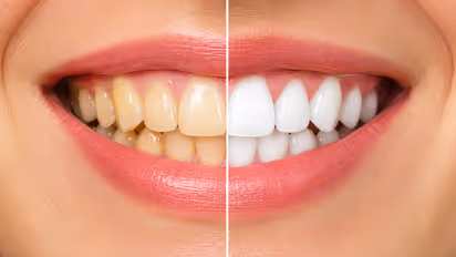 teeth