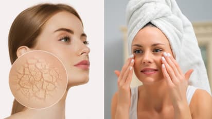 Wnter skin and lips care 