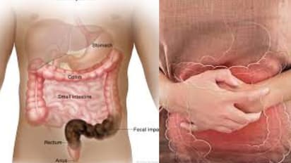 How to prevent gas and constipation naturally