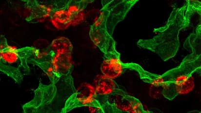 Newly formed alveolar type 2 (AT2) cells (red) and alveolar type 1 (AT1) cells (green) work together to repair lung tissue and maintain healthy oxygen exchange