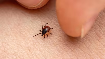 Scrub Typhus