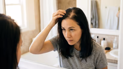 Science of DHT and Graft Survival in Hair Restoration Explained