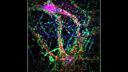 Microscopic intercellular nanotubes (green) form bridge-like connections between neurons, adding a new layer of communication in the brain