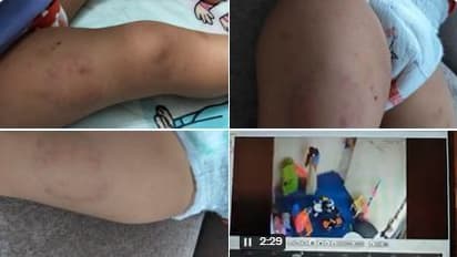 Noida daycare centre staff beats 15-month-old baby