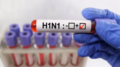 h1n1 virus