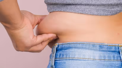 belly fat