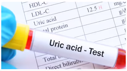 uric acid