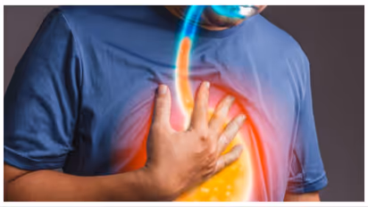 acid reflux