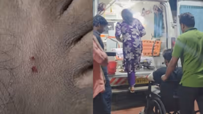 two snake bite cases reported in thamarassery within one day