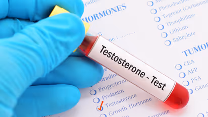 testosterone
