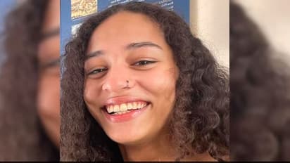 US College Student died by pitbull attack