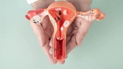 Vaginal Yeast Infections