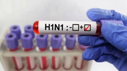 h1n1 virus