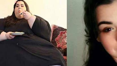 300 കിലോയില് നിന്നും ശരീരഭാരം കുറച്ച് അവര് അത്ഭുതമാകുന്നു