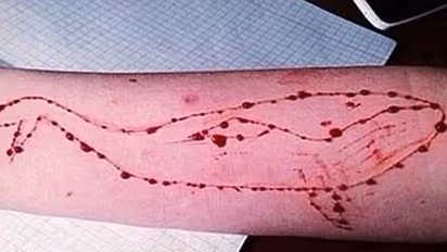 Suicide game enters Mangalore, child with Blue Whale injury found