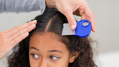 ಮಕ್ಕಳ ತಲೇಲಿ ಹೇನಾದ್ರೇನು ಮಾಡಬೇಕು, ಇಲ್ಲಿವೆ ಸಿಂಪಲ್ ಟಿಪ್ಸ್