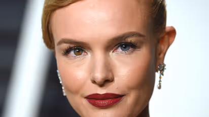 Eye don't believe this! Celebrities with different-coloured eyes