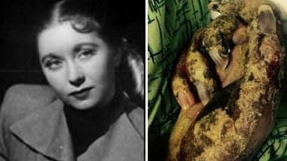 ఆ మోడల్ను సజీవంగా తినేసిన పరాన్నజీవులు!